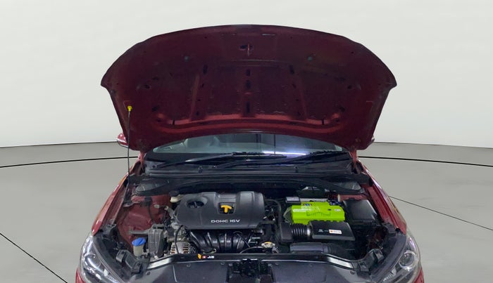 2017 Hyundai New Elantra 2.0 SX MT PETROL, Petrol, Manual, 95,809 km, Open Bonet