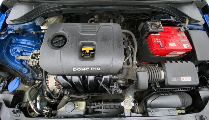 2017 Hyundai New Elantra 2.0 SX (O) AT, Petrol, Automatic, 83,832 km, Open Bonet
