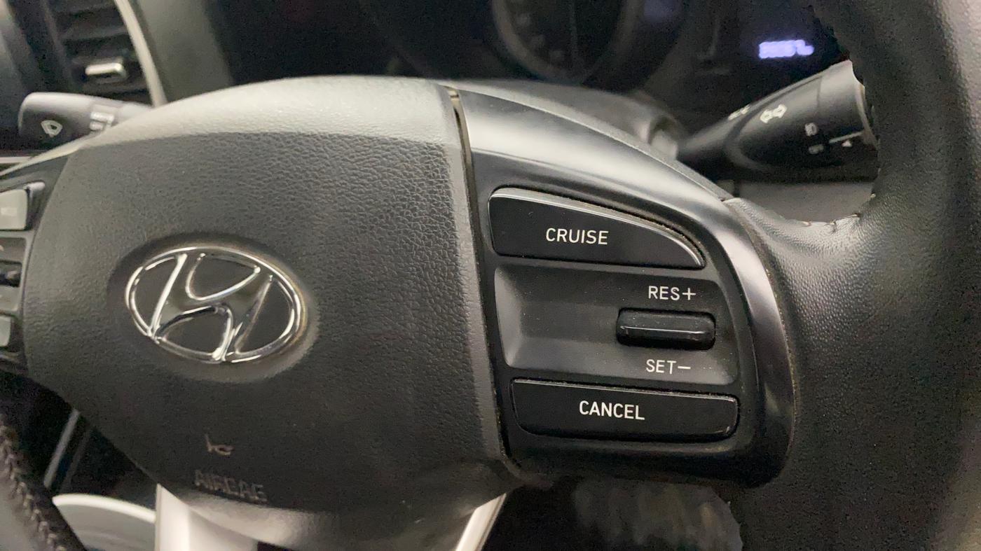 2021 Hyundai VENUE SX 1.5 CRDI, Diesel, Manual, 38,984 km, Adaptive Cruise Control