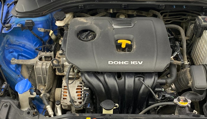 2017 Hyundai New Elantra 2.0 SX MT PETROL, Petrol, Manual, 48,625 km, Engine View - Right