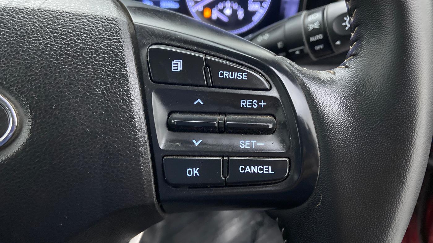 2019 Hyundai VENUE SX(O) CRDi, Diesel, Manual, 30,521 km, Adaptive Cruise Control